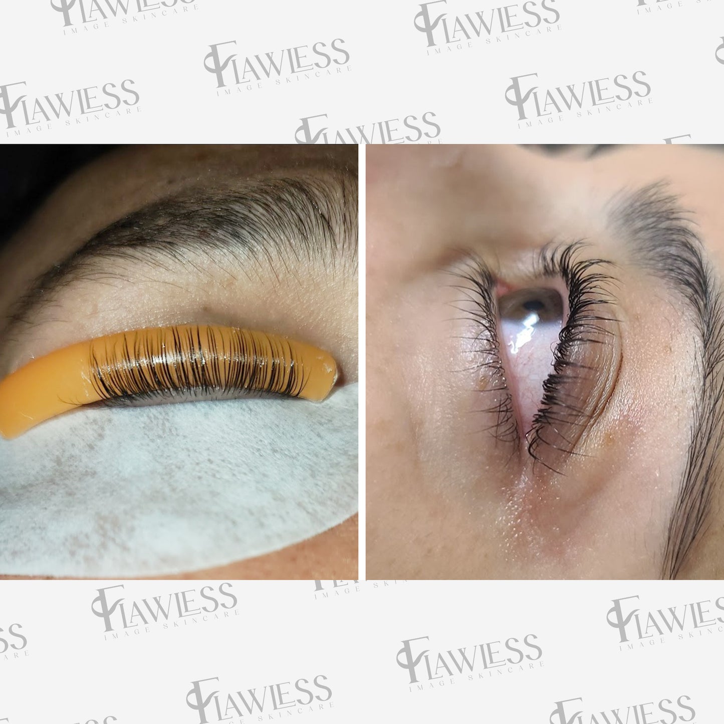 Lash Lift