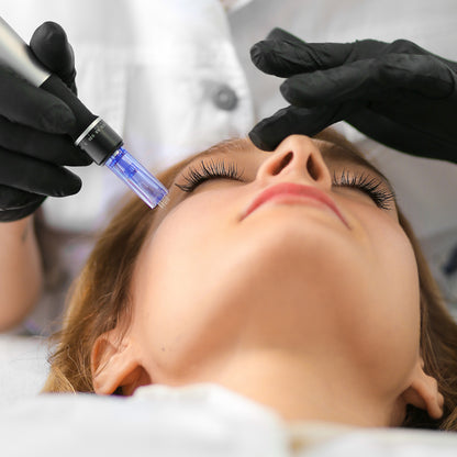 Microneedling